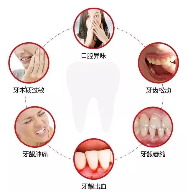 最新牙龈再生技术,重塑自信灿烂笑容的秘诀