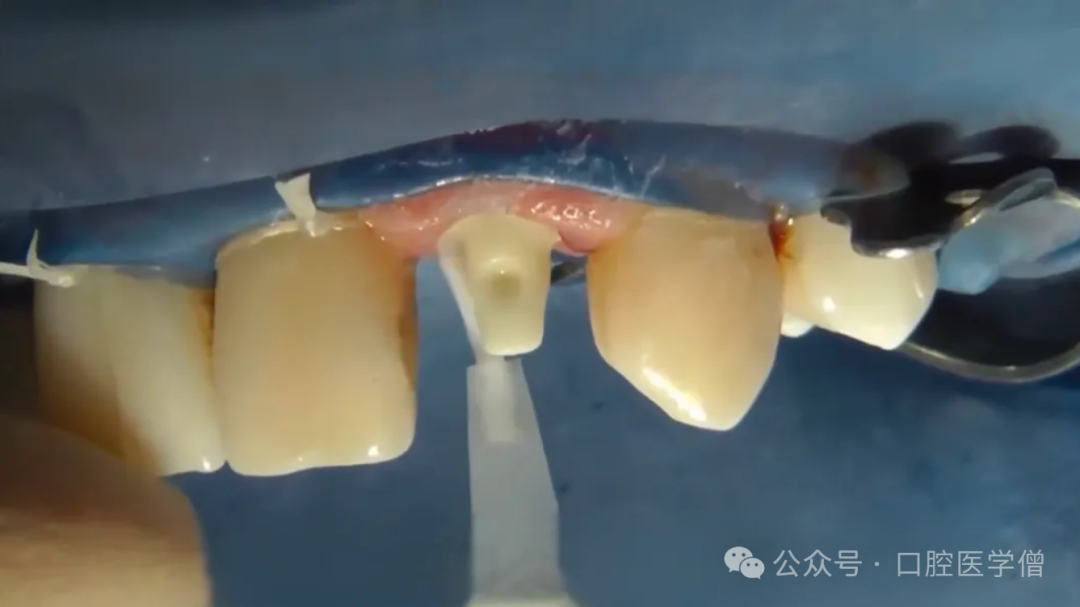 最新牙齿再生技术,自然美景之旅唤醒内心喜悦与平静