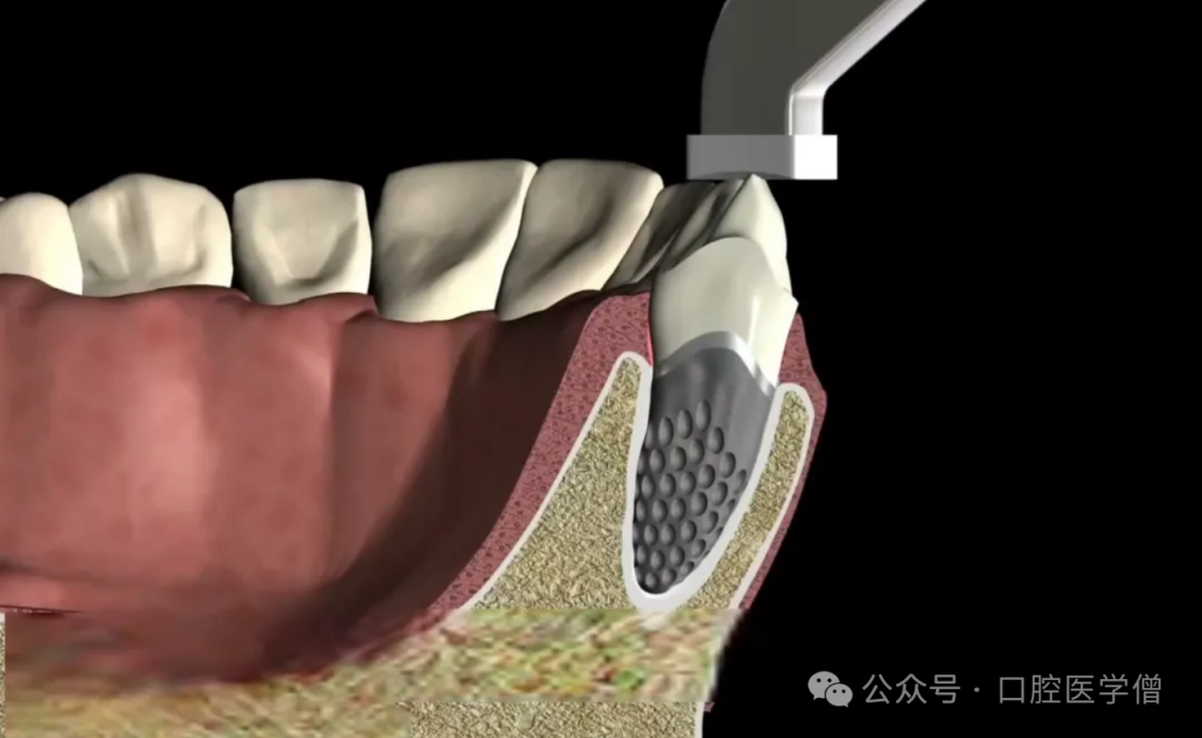最新牙齿再生技术,自然美景之旅唤醒内心喜悦与平静