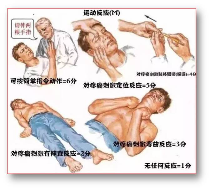 最新意识障碍分级标准,最新意识障碍分级标准,背景、影响与地位
